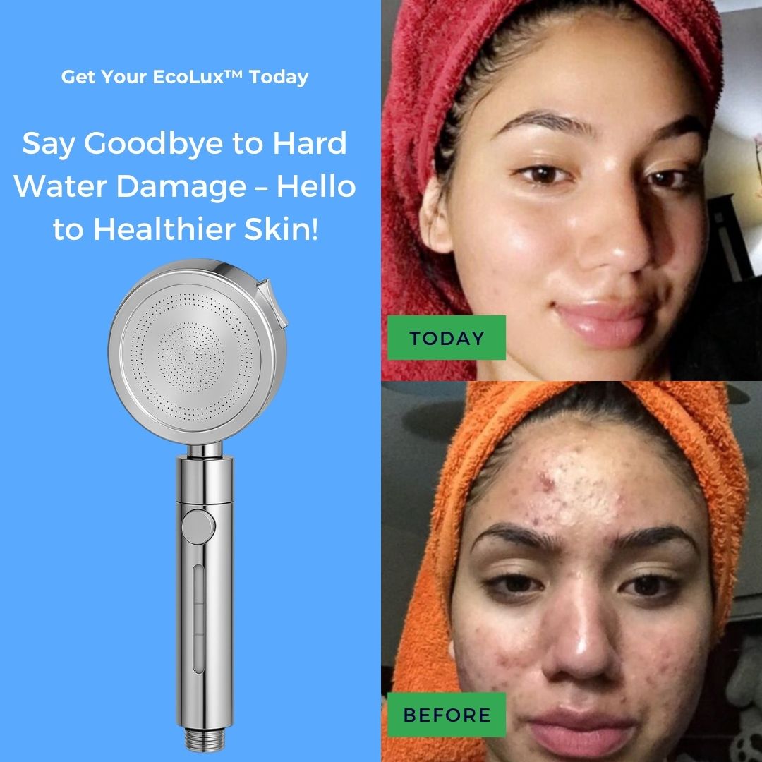 EcoLux™ Pro Filtered Shower head