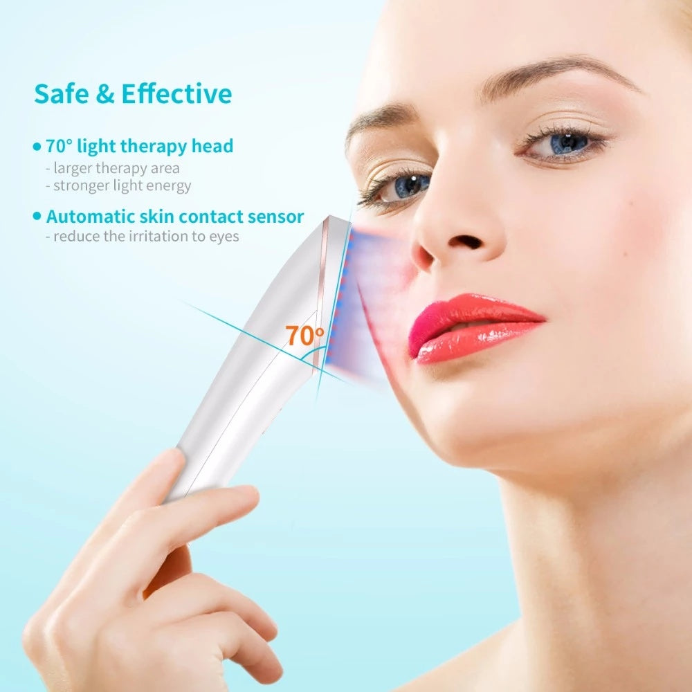 Handheld LED Acne Therapy Device for Clearer Skin