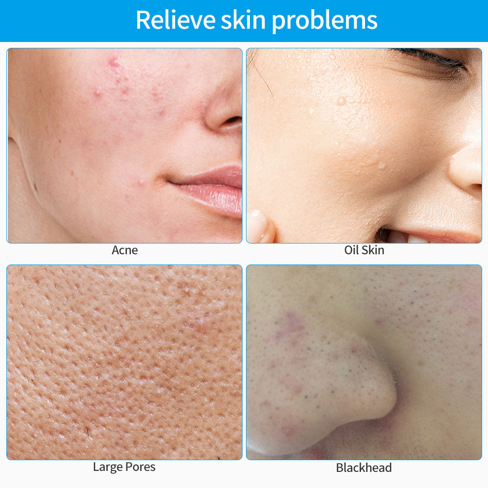 Eco-Friendly Electric Facial Cleansing Brush - Silicone Bristles, Rechargeable, Pink/Blue/Purple