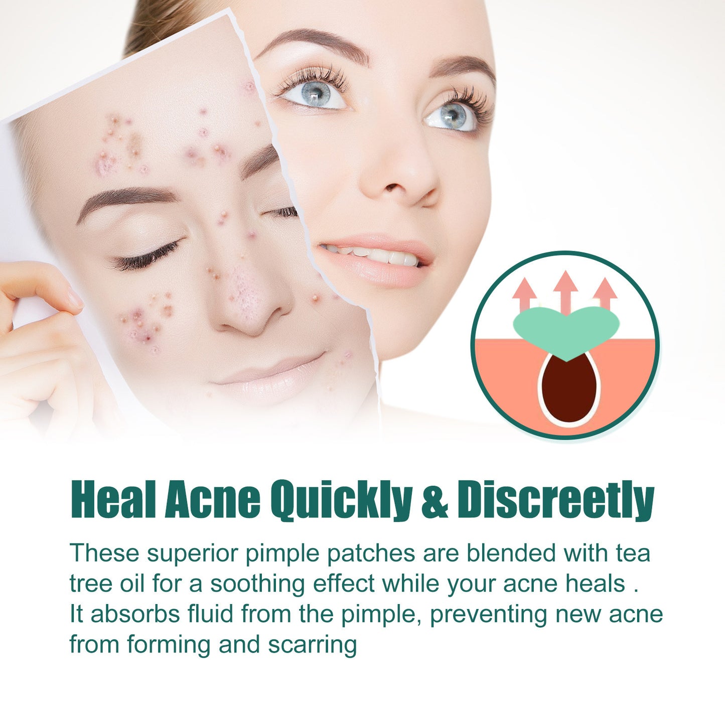 Heart-Shaped Colorful Acne Patches for Clear Skin