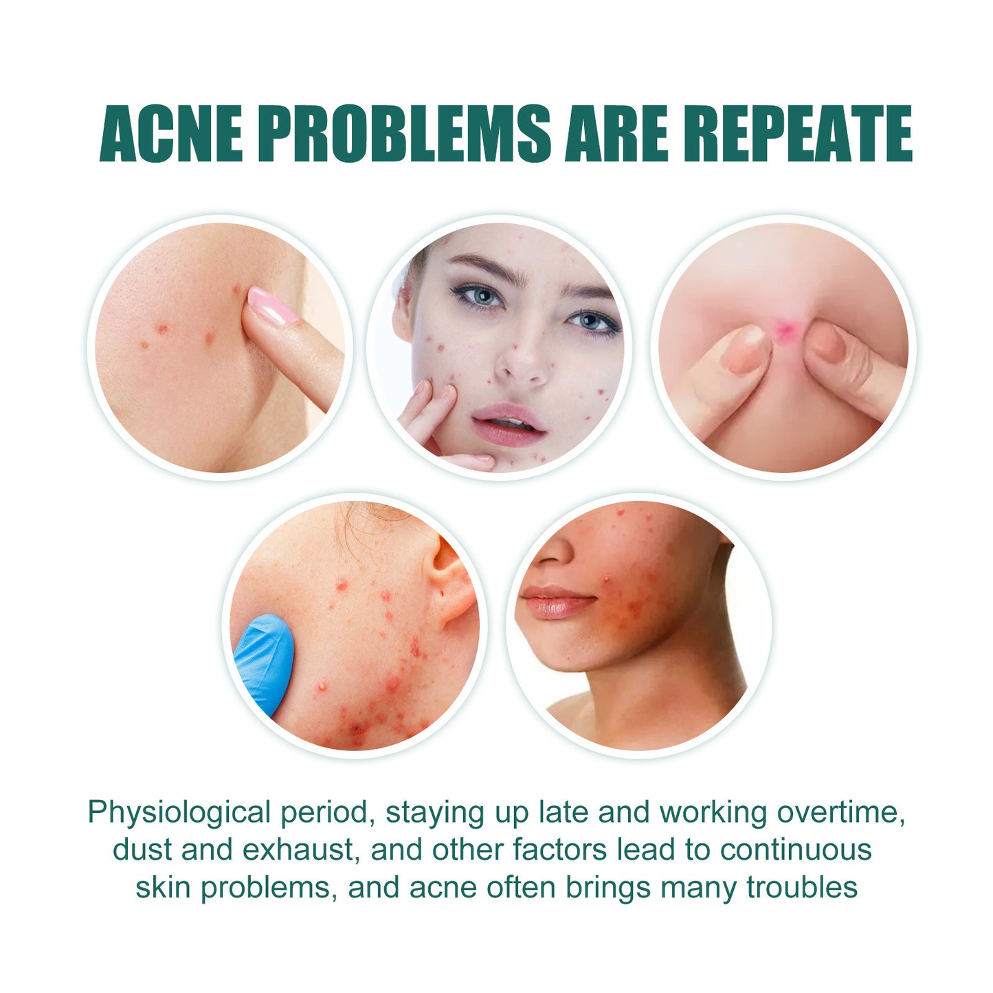 Heart-Shaped Colorful Acne Patches for Clear Skin