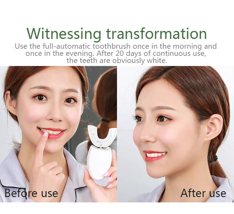Intelligent U-Type Toothbrush 360 Degrees Sonic Electric Automatic with USB Charge Waterproof Silicon Head for Oral Care