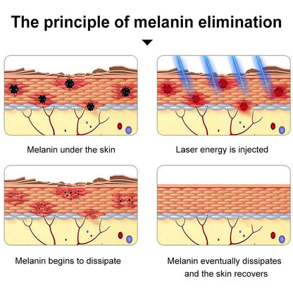 Tattoo Scar Freckle Removal Machine Adjustable Frequency Dark Spot Remover Machine Digital Display for Wart Spot Small Tattoo