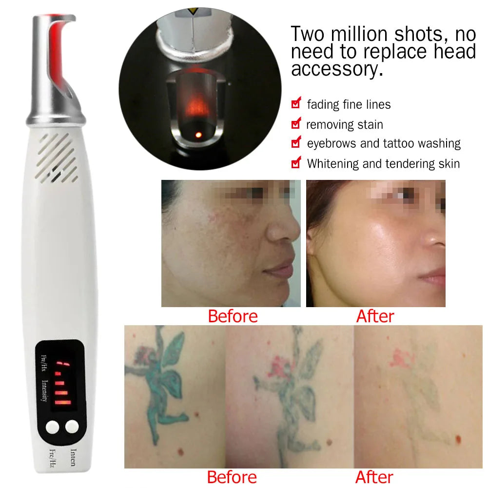 Tattoo Scar Freckle Removal Machine Adjustable Frequency Dark Spot Remover Machine Digital Display for Wart Spot Small Tattoo