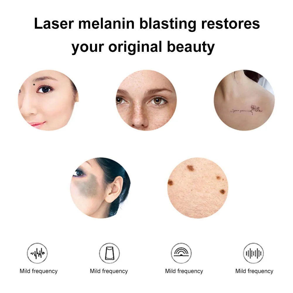 Tattoo Scar Freckle Removal Machine Adjustable Frequency Dark Spot Remover Machine Digital Display for Wart Spot Small Tattoo