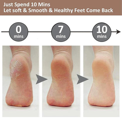 Electric Callus Remover for Feet,Rechargeable Foot Exfoliator Foot Scrubber Pedicure Tools,Removes Dry Skin for Smoother Feet