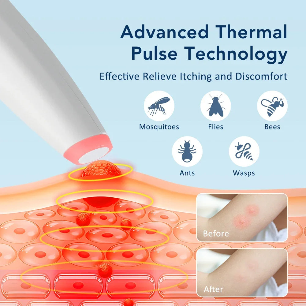 Mosquito Bite Relief Pen - Portable, Eco-Friendly Itch Soother