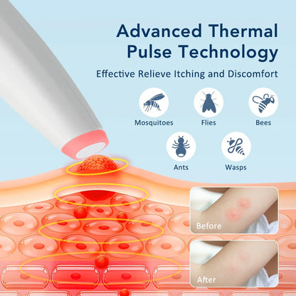 Mosquito Bite Relief Pen - Portable, Eco-Friendly Itch Soother