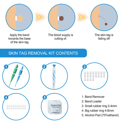 Eco-Friendly Skin Tag Removal Kit with Micro Band Applicator