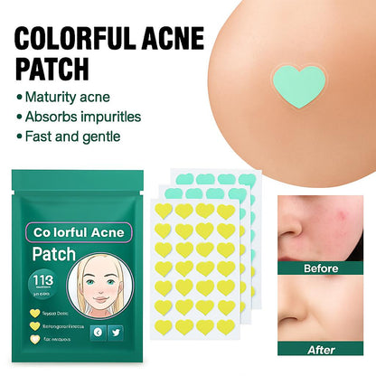 Heart-Shaped Colorful Acne Patches in Eco-Friendly Packaging