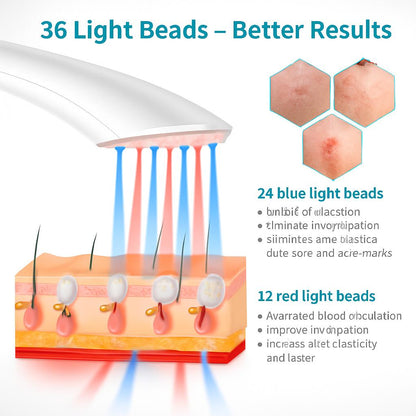 Handheld LED Acne Therapy Device for Clearer Skin
